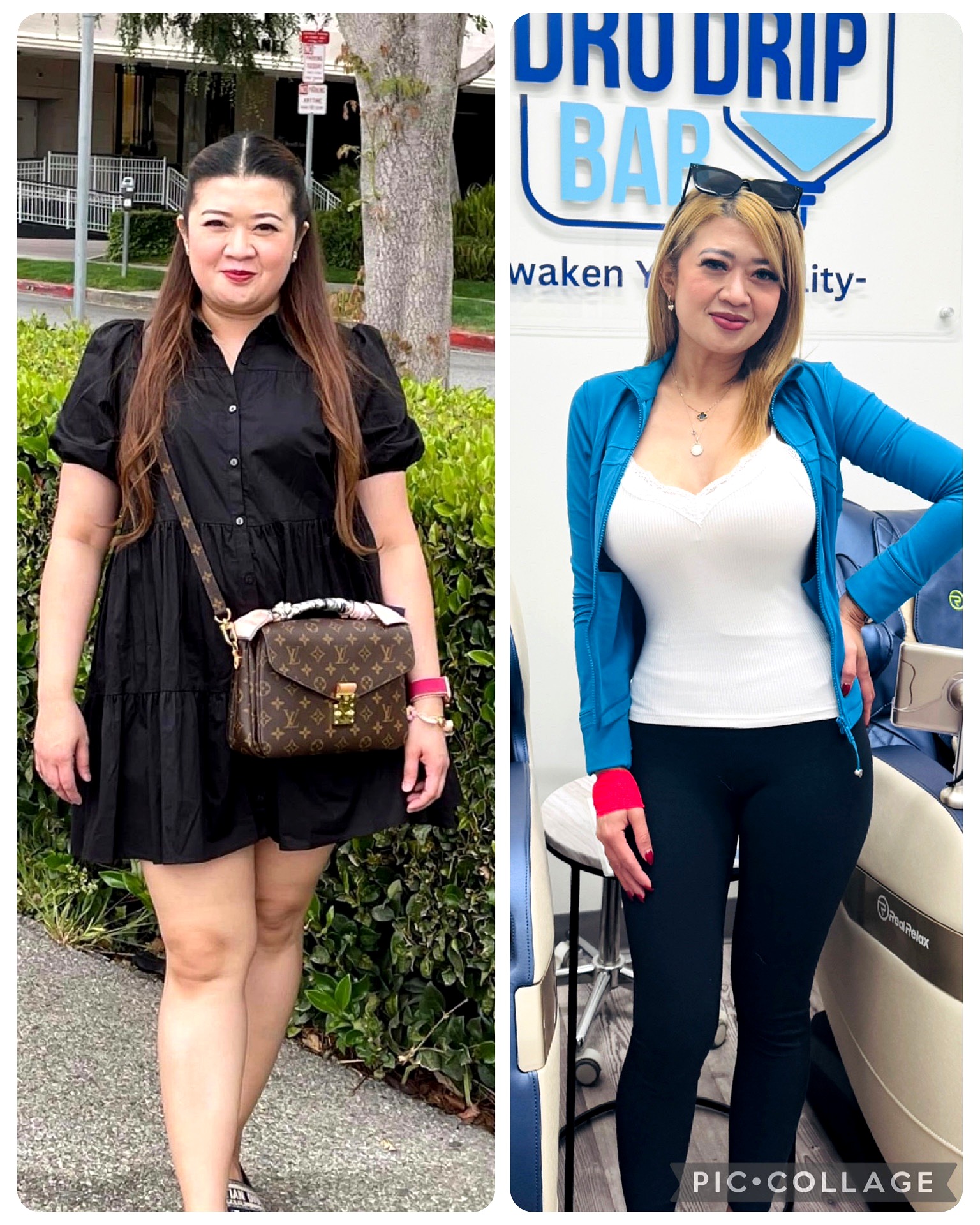 75 lbs weight loss The Hydro Drip Bar